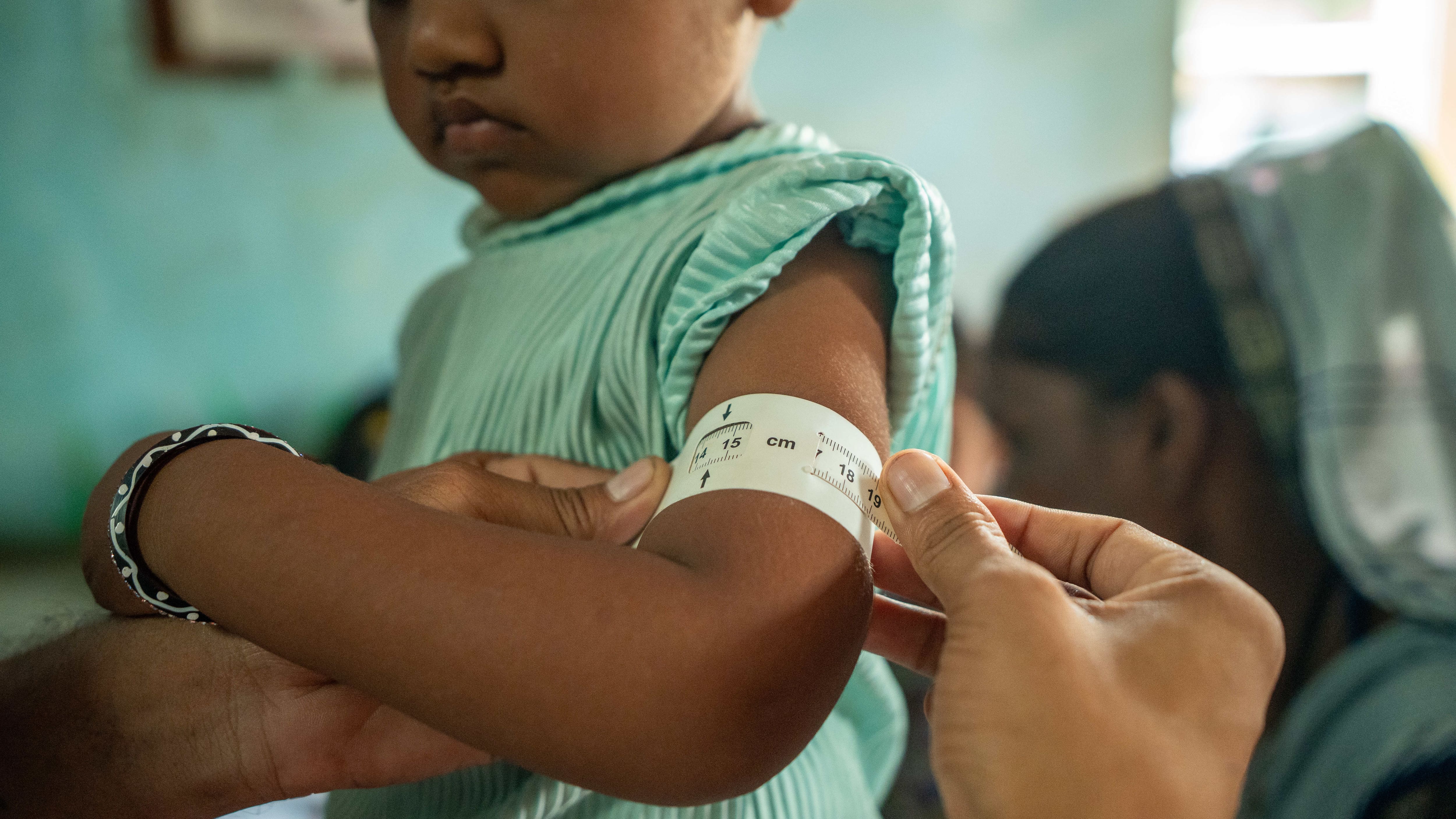 Why child nutrition matters for India's future