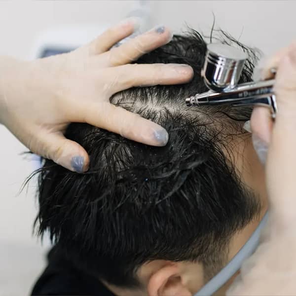 Scalp O2