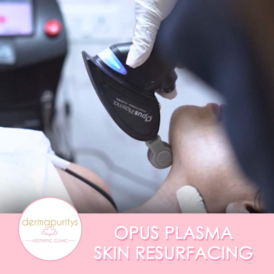 Opus Plasma Skin Resurfacing