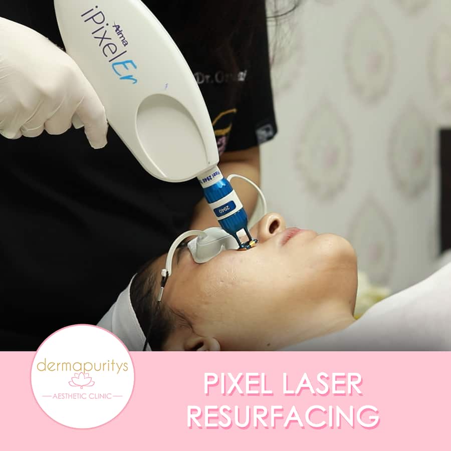 Pixel Laser Resurfacing