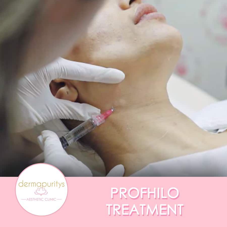 Profhilo Treatment
