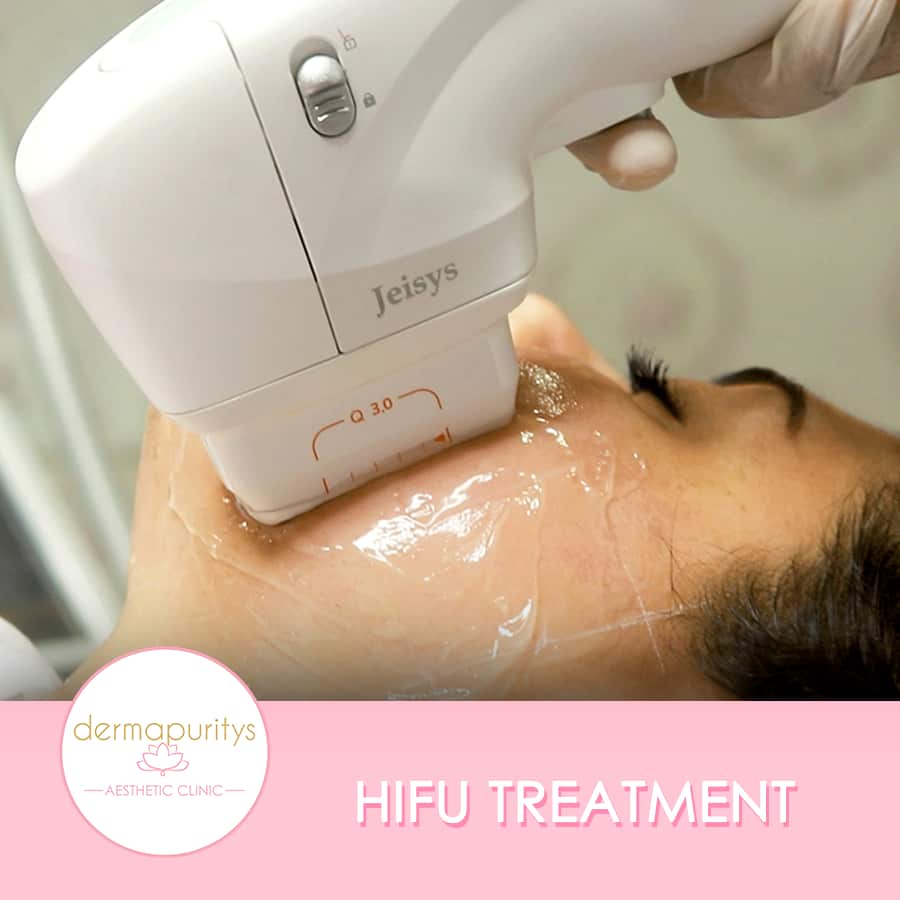 Hifu Treatment