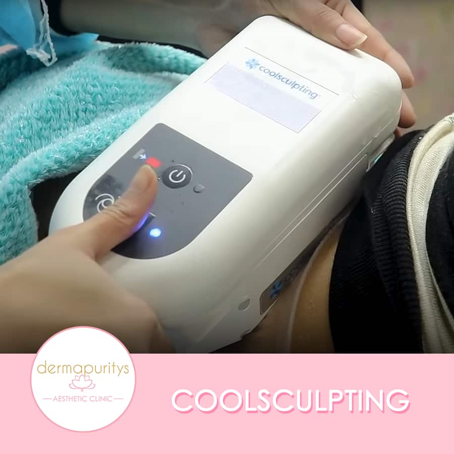 Coolsculpting