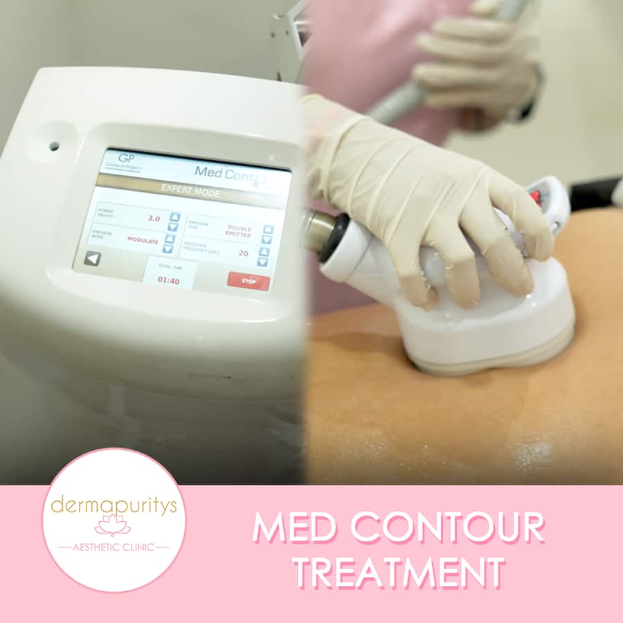 Med contour treatment